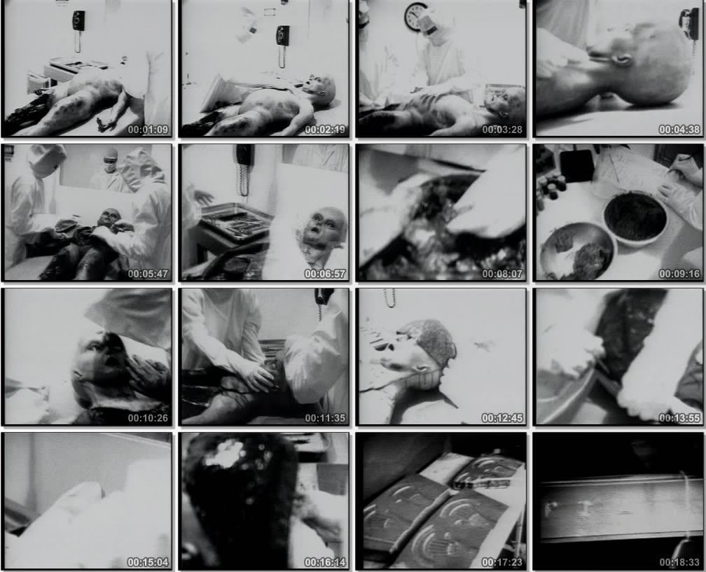 Proof of The Alien Autopsy Video Was Hoax